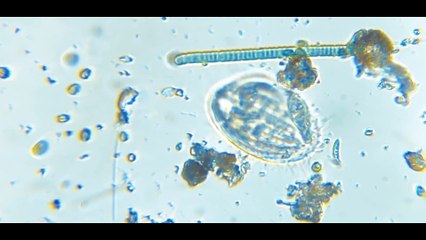 Présentation du kit microscope Diple pour smartphones