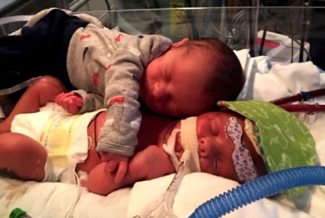 Gemelos: el 'abrazo fraternal' que ni la muerte podrá borrar