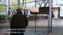 Exibição utiliza raios X de vítimas de violência doméstica