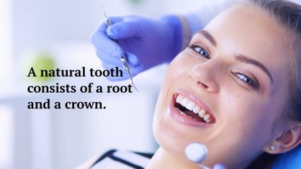 5 Reasons Why Dental Implants are Better Than Bridges!