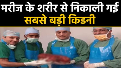 Delhi : 7.4 kg kidney, equivalent to weight of 2 newborns, removed from man| वनइंडिया हिंदी