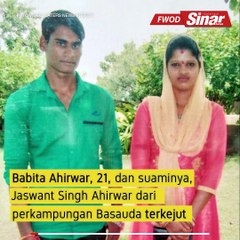 Ibu terkejut lahirkan bayi dua kepala, tiga tangan
