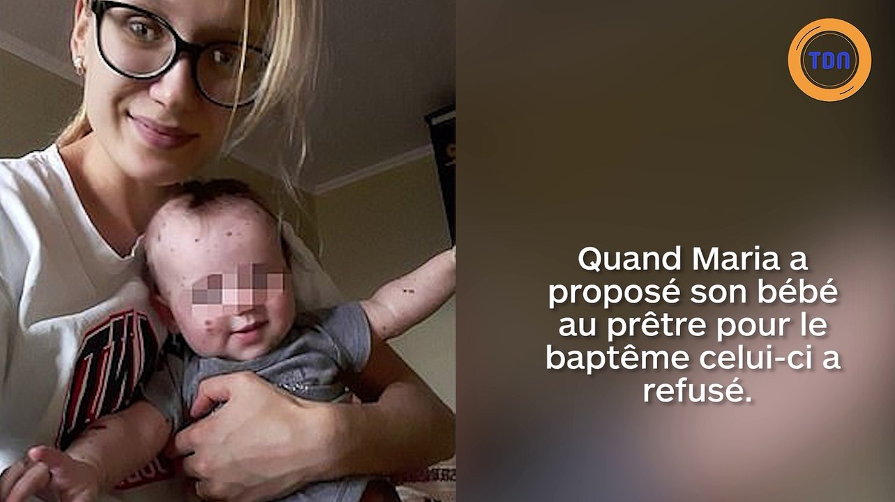 Le prêtre refuse de le baptiser à cause de sa tache de naissance