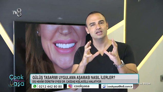Kişiye özel gülüş tasarımı nasıl yapılıyor?