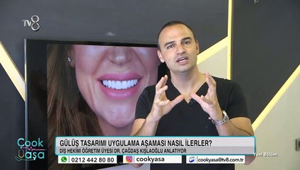 Kişiye özel gülüş tasarımı nasıl yapılıyor?