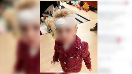 El hijo de Chiara Ferragni tiene un accidente que le deja una brecha
