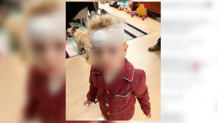El hijo de Chiara Ferragni tiene un accidente que le deja una brecha