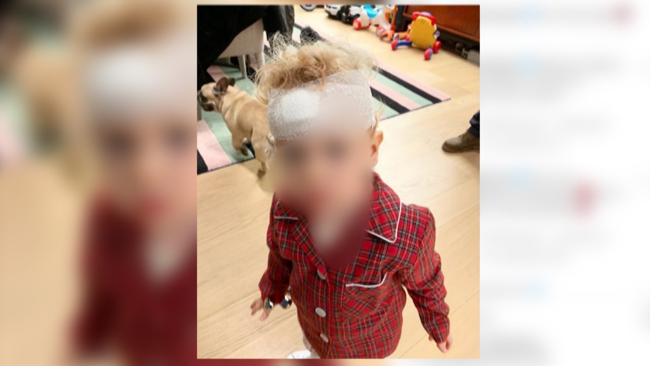 El hijo de Chiara Ferragni tiene un accidente que le deja una brecha