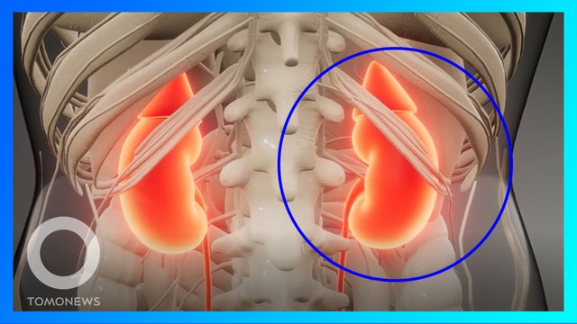 世界最大腎臟重達7.4公斤 印部醫師動手術取出