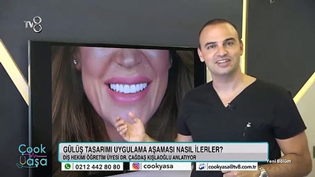 Gülüş tasarımı ile dişleriniz nasıl gözükür?