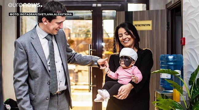 Мама Луны, родившейся с маской Бэтмена , показала результаты первой операции