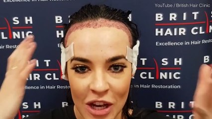 Steph Davis has hair transplant after years of battling insecurities