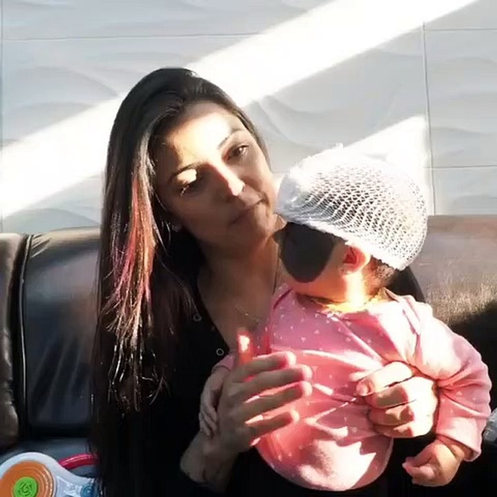 La madre de la bebé nacida en EE.UU. con 'máscara de Batman' muestra los primeros resultados del tratamiento