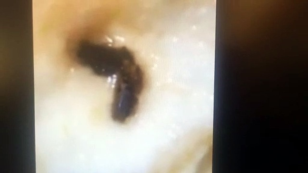Maggot found in apple