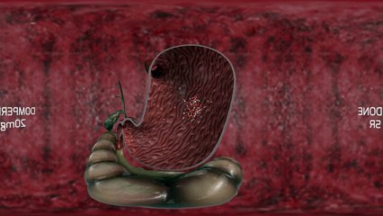 3D Medical Animation