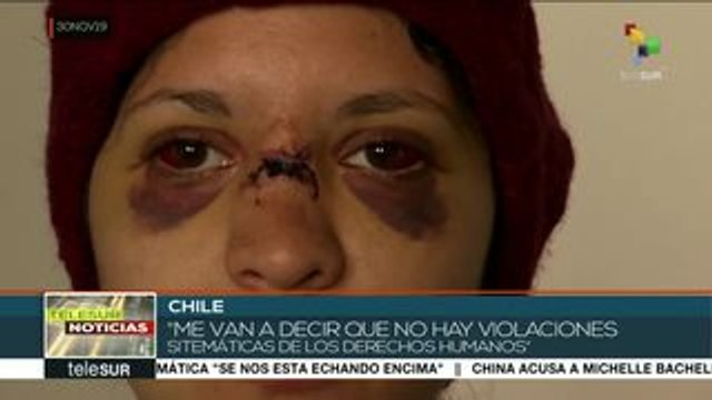 teleSUR Noticias: 11 días de protestas en Colombia