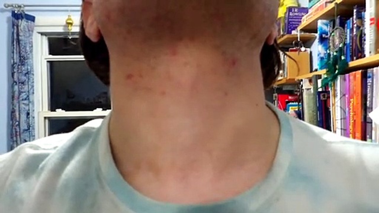 My Neck