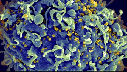 HIV research: Scientists confirm new viral strain