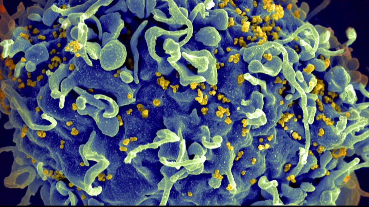 HIV research: Scientists confirm new viral strain