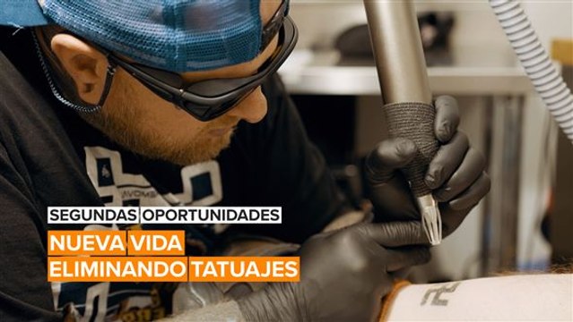 Segundas oportunidades: Nueva vida eliminando tatuajes