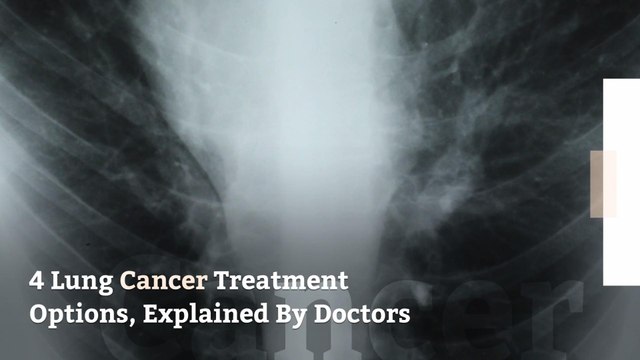 4 Lung Cancer Treatment Options, Explained By Doctors