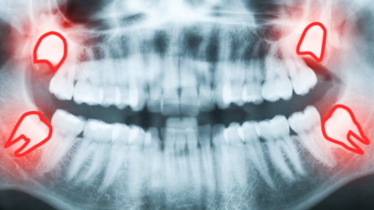 6 of the most inconvenient things evolution left us with