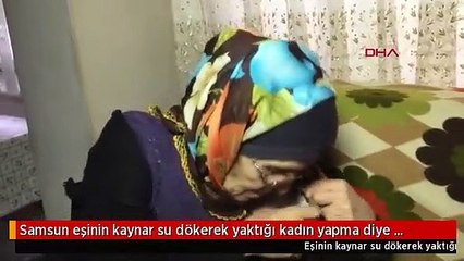Samsun eşinin kaynar su dökerek yaktığı kadın yapma diye yalvardım