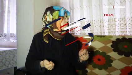 Eşinin kaynar su dökerek yaktığı kadın: Yapma diye yalvardım