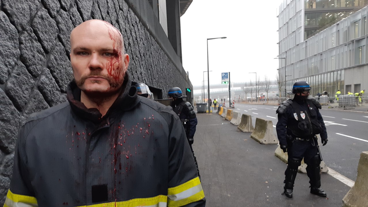 Retraites : Jonathan, un pompier, a été blessé dans la manifestation à Lille