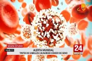 Alerta mundial: tintes para el cabello causarían cáncer de mama