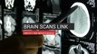Brain Scans Link Obesity And Brain Damage