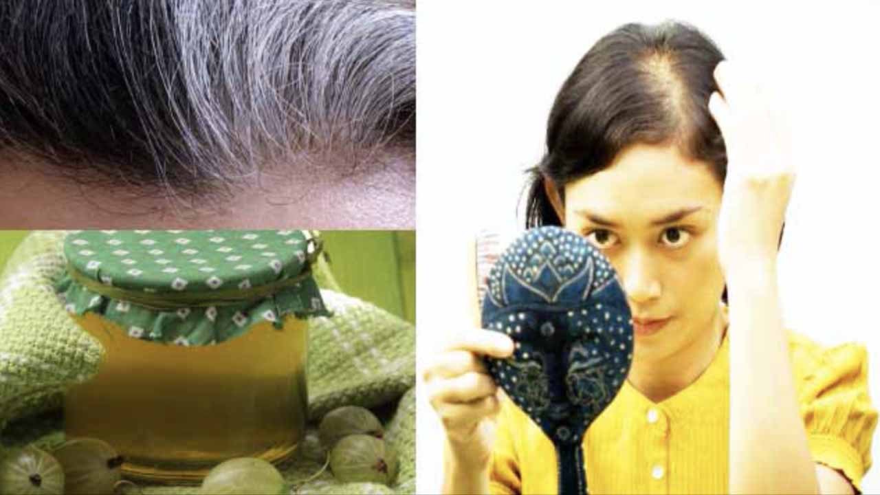 झड़ते बालों की वजह से बढ़ रहा है गंजापन तो ये तिब्बती आयुर्वेदिक नुस्खा दे सकता है राहत | Boldsky