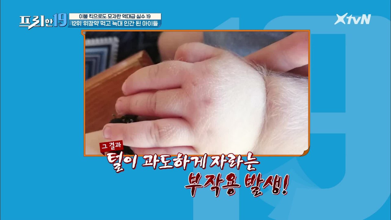 OO약 먹고 늑대 인간 된 아이들 [이불 킥으로도 모자란 역대급 실수 19]