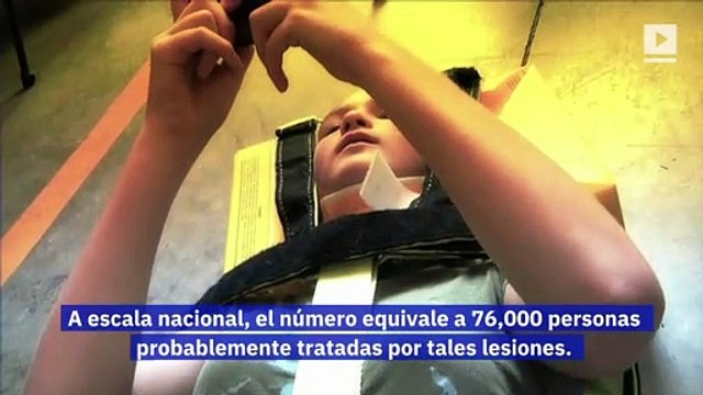 Las lesiones en la cabeza y el cuello debido al uso de teléfonos celulares están aumentando 'abruptamente'