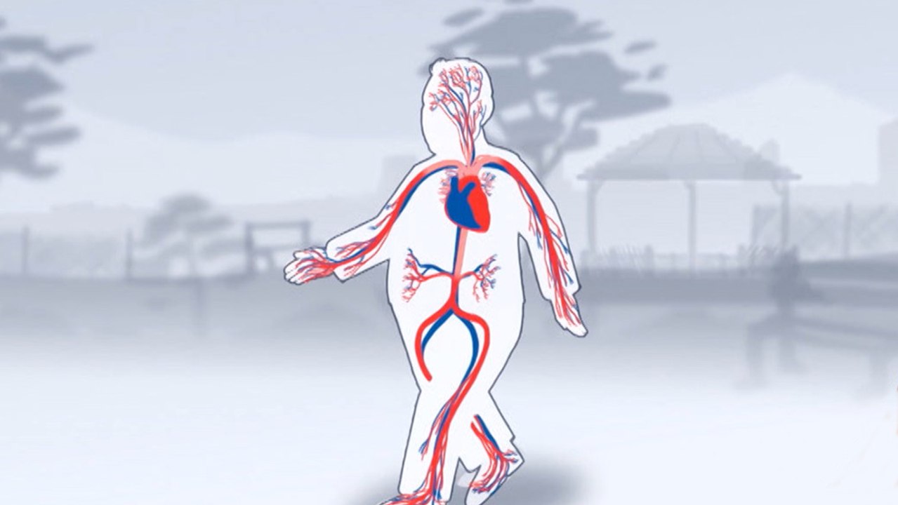 bd-arterias-enfermas-por-colesterol-091219