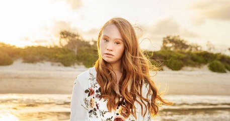 Madeline Stuart, la première mannequin atteinte de trisomie 21