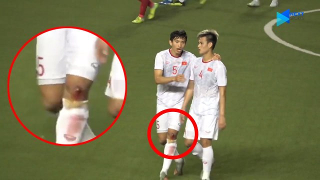 Ghi siêu phẩm vào lưới Indonesia, Văn Hậu chân be bét máu | NEXT SPORTS