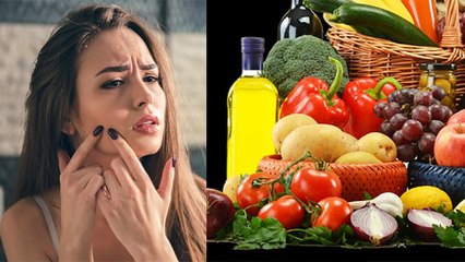 कील-मुहांसों का डाइट से है कनेक्शन,न करे इस खाने का सेवन! Pimple connection with your diet !।Boldsky