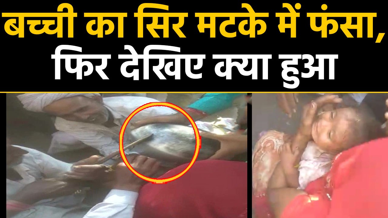 Rajasthan में स्टील के मटके में फंसा बच्ची का सिर, फिर देखिए कैसे बची मासूम की जान | वनइंडिया हिंदी
