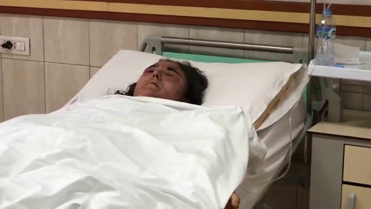 Pamje nga spitali, Manjola Cakoni njëra nga të plagosurat