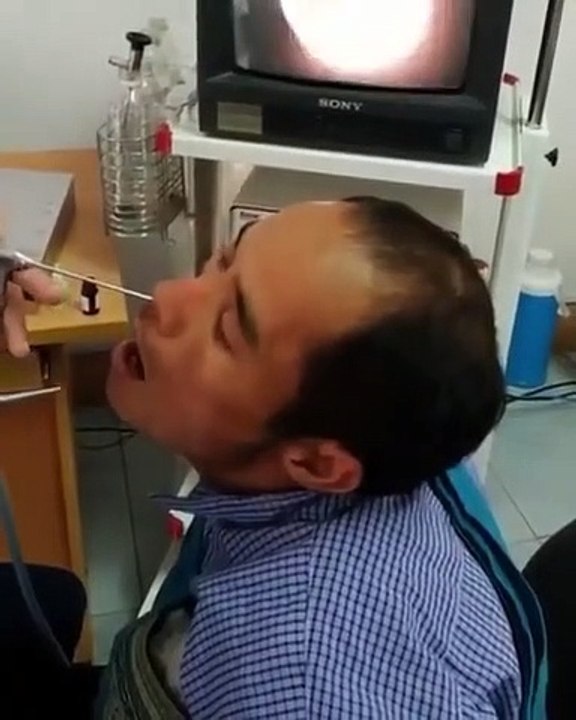 Il a demandé au médecin de voir s’il y a quelque chose dans son nez, le médecin a fait sortir un gros vers noir