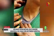 Zapallal: Denuncian que joven con discapacidad es constantemente golpeada por su madre