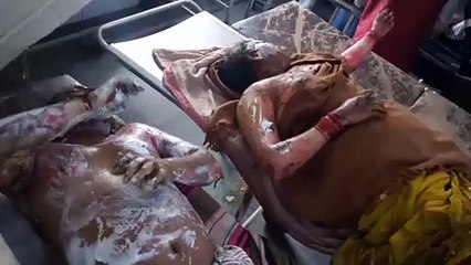 Скачать видео: शाहजहांपुर में गैस पर खाना बनाते समय लीकेज से लगी आग, आग की चपेट में आए 3 लोग