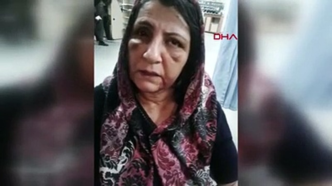 Ellerin kırılsın... Bu kadını bu hale öz oğlu getirdi