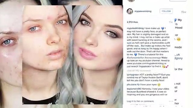 'You look disgusting' - Interview with beauty blogger who shamed bullies - BBC Trending