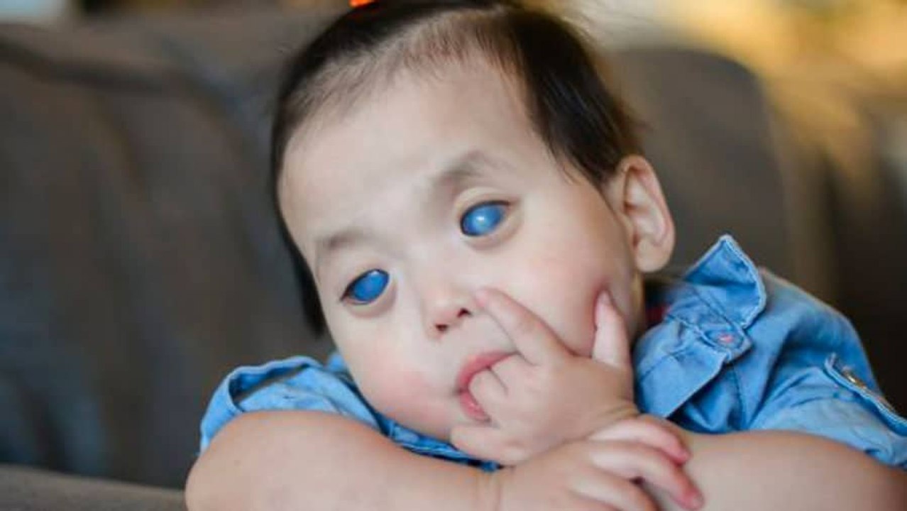 L'histoire de Primrose, une petite fille aux yeux complètement bleus