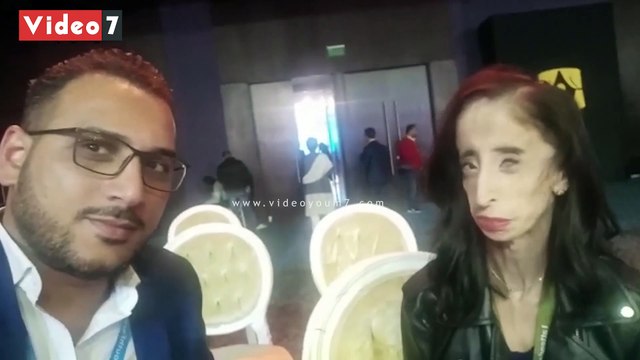 لقبوها بأقبح سيدة على الأرض.. اليوم السابع يحاور ليزي صاحبة أشهر واقعة تنمر في العالم