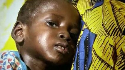 BBC - Horizon - 2005 - Malaria Defeating The Curse