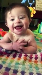 Down Sendromlu Ufaklığı Evlat Edinen Anne ve Onun Söylediği Güzel Kelimelere Dünyalara Bedel Gülümsemesiyle Cevap Veren Ufaklık