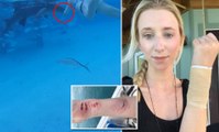 El aterrador momento en que una mujer es mordida por un tiburón en plena luna de miel